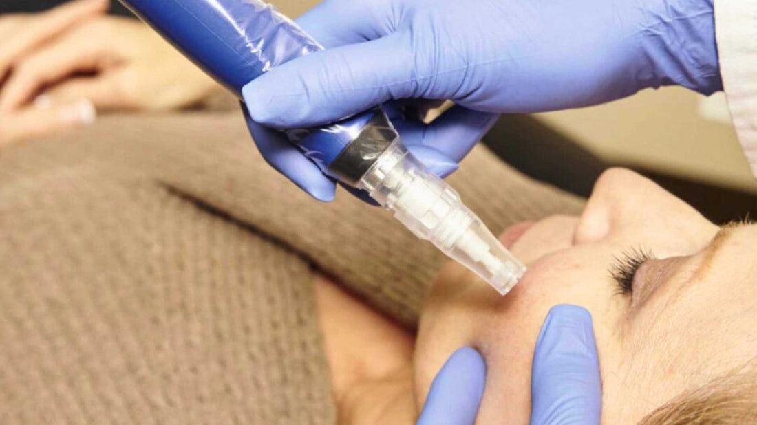 SkinPen® Microneedling: Is It Right For Your Skin?